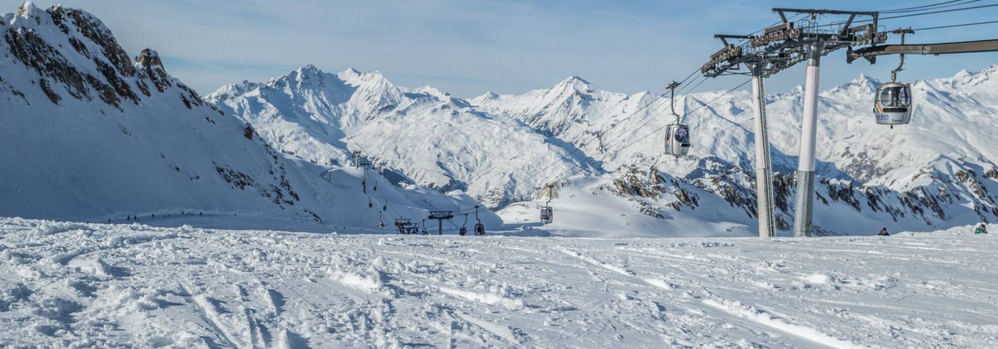 Les arcs